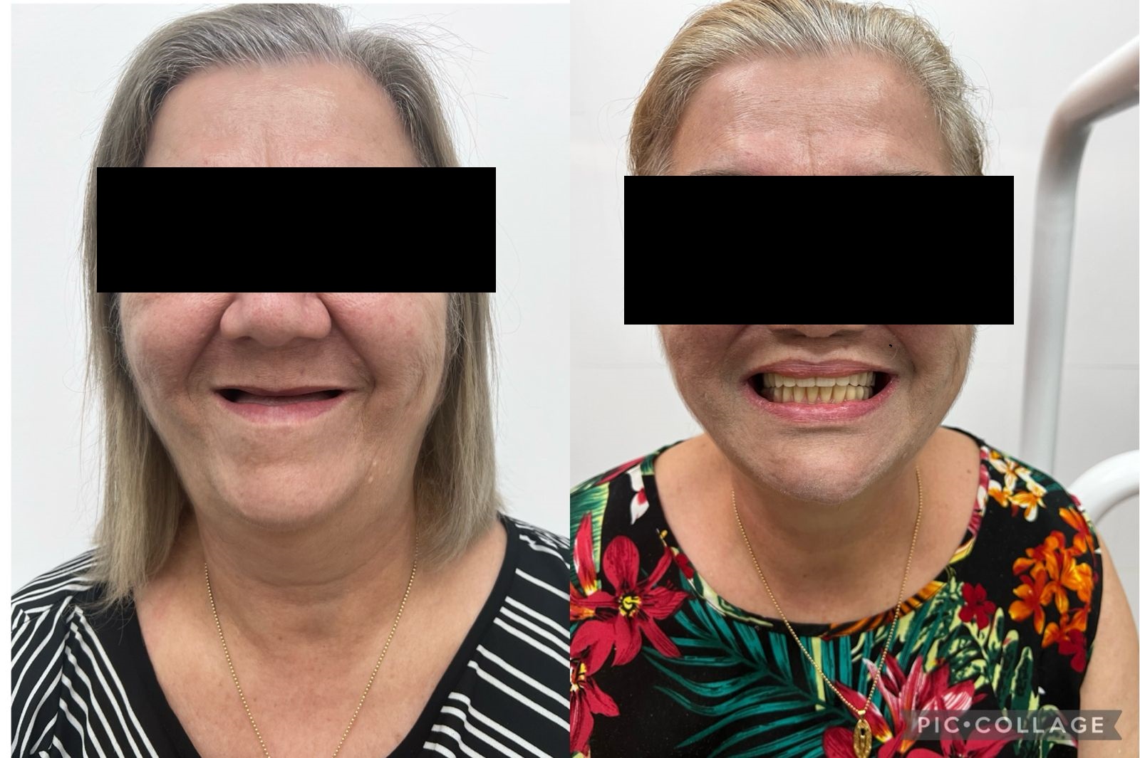 Transformação Caso 3 - Dona Lúcia.